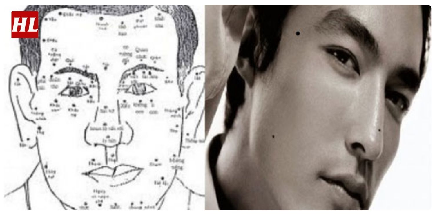 vị trí nốt ruồi trên mặt đàn ông