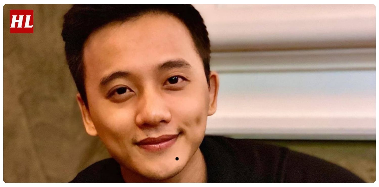 vị trí nốt ruồi trên mặt đàn ông